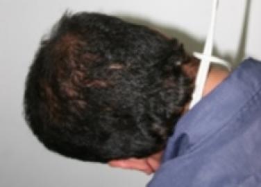 شرطي بتاوريرت في حالة استيداع مرضي ينتحر شنقا.