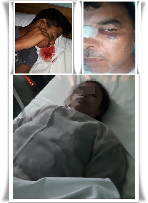 سيارة تصدم طفلا و والده يتعرض للضرب و الاعتداء و أمه لنوبة قلبية