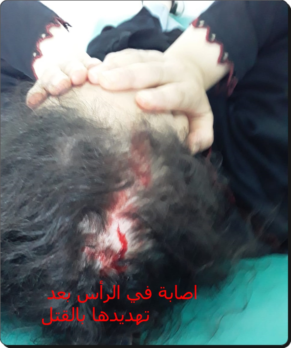 خطير جدا ما يفعله هذا الطليق بطليقته و والدتها و شقيقها بالفيديو و الصور و الشواهد الطبية اليكم التفاصيل