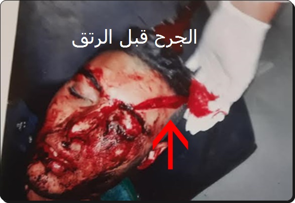 سيدي بنور:بالصور محاولة قتل يتم التداول في تحويرها الى حادثة سير و صاحبة العربة تنفي ذلك