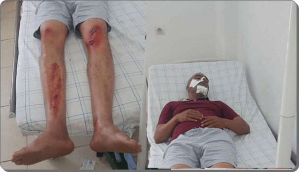 متهور يدهس خليفة قائد الوالدية و هو يزاول عمله و ينجو من موت محقق