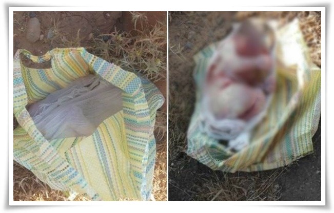 جثة جنين غير مكتملة النمو بين مخلفات القمامة