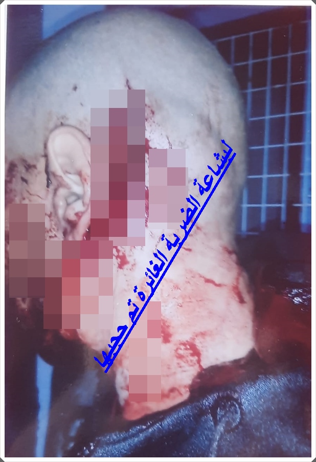 اعتداء الى حد تصفية جسدية بجماعة سيدي اعلي بن حمدوش و الضحية يتقدم بشكاية الى السيد الوكيل مآزرا بجمعية حقوقية